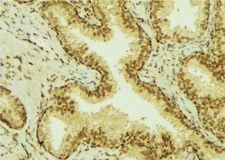 UGT1A4 Antibody - 1:100 staining mouse colon tissue by IHC-P. The sample was formaldehyde fixed and a heat mediated antigen retrieval step in citrate buffer was performed. The sample was then blocked and incubated with the antibody for 1.5 hours at 22°C. An HRP conjugated goat anti-rabbit antibody was used as the secondary.