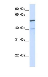UGT1A6 Antibody - 293T cell lysate. Antibody concentration: 1.0 ug/ml. Gel concentration: 12%.  This image was taken for the unconjugated form of this product. Other forms have not been tested.