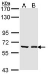 UGT1A6 Antibody - Sample (30 ug of whole cell lysate). A: A431. B: H1299. 7.5% SDS PAGE. UGT1A6 antibody diluted at 1:1000. 