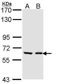 UGT1A6 Antibody - Sample (30 ug of whole cell lysate). A: A431. B: H1299. 7.5% SDS PAGE. UGT1A6 antibody diluted at 1:1000. 