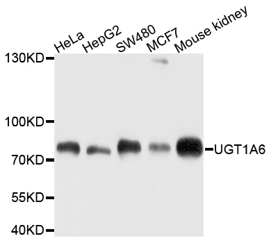UGT1A6 Antibody - Western blot analysis of extracts of various cell lines, using UGT1A6 antibody at 1:1000 dilution. The secondary antibody used was an HRP Goat Anti-Rabbit IgG (H+L) at 1:10000 dilution. Lysates were loaded 25ug per lane and 3% nonfat dry milk in TBST was used for blocking. An ECL Kit was used for detection and the exposure time was 60s.