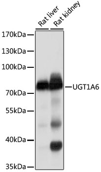 UGT1A6 Antibody - Western blot analysis of extracts of various cell lines, using UGT1A6 antibodyat 1:1000 dilution. The secondary antibody used was an HRP Goat Anti-Rabbit IgG (H+L) at 1:10000 dilution. Lysates were loaded 25ug per lane and 3% nonfat dry milk in TBST was used for blocking. An ECL Kit was used for detection and the exposure time was 10s.