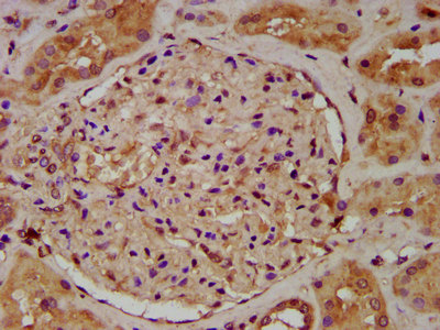 UGT1A6 Antibody - Immunohistochemistry image at a dilution of 1:200 and staining in paraffin-embedded human kidney tissue performed on a Leica BondTM system. After dewaxing and hydration, antigen retrieval was mediated by high pressure in a citrate buffer (pH 6.0) . Section was blocked with 10% normal goat serum 30min at RT. Then primary antibody (1% BSA) was incubated at 4 °C overnight. The primary is detected by a biotinylated secondary antibody and visualized using an HRP conjugated SP system.