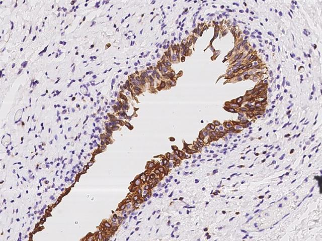 UGT1A6 Antibody - Immunochemical staining of human UGT1A6 in human urinary bladder with rabbit polyclonal antibody at 1:100 dilution, formalin-fixed paraffin embedded sections.