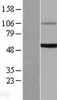 UGT1A6 Protein - Western validation with an anti-DDK antibody * L: Control HEK293 lysate R: Over-expression lysate