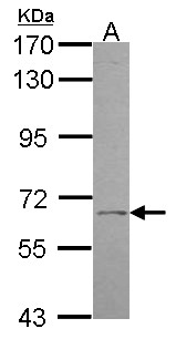 UGT1A9 Antibody - Sample (30 ug of whole cell lysate). A: H1299. 7.5% SDS PAGE. UGT1A9 antibody. UGT1A9 antibody diluted at 1:1000.