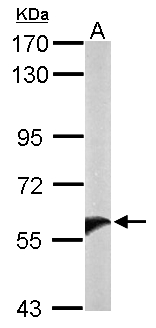 UGT1A9 Antibody - Sample (50 ug of whole cell lysate). A: mouse liver. 7.5% SDS PAGE. UGT1A9 antibody diluted at 1:10000.