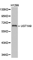 UGT1A9 Antibody - Western blot of extracts of H1299 cell lines, using UGT1A9 antibody.
