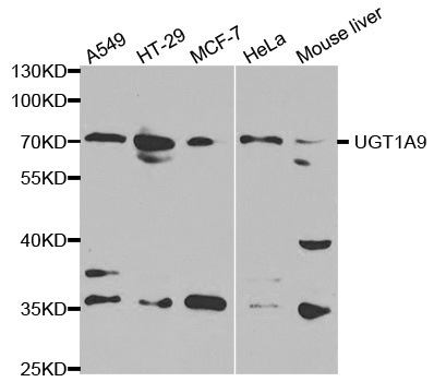 UGT1A9 Antibody - Western blot analysis of extracts of various cell lines, using UGT1A9 antibody at 1:1000 dilution. The secondary antibody used was an HRP Goat Anti-Rabbit IgG (H+L) at 1:10000 dilution. Lysates were loaded 25ug per lane and 3% nonfat dry milk in TBST was used for blocking.