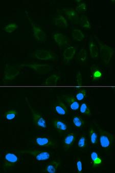 UGT1A9 Antibody - Immunofluorescence analysis of MCF-7 cells using UGT1A9 antibody. Blue: DAPI for nuclear staining.