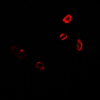 UGT1A9 Antibody - Immunofluorescent analysis of GNT1 staining in MCF7 cells. Formalin-fixed cells were permeabilized with 0.1% Triton X-100 in TBS for 5-10 minutes and blocked with 3% BSA-PBS for 30 minutes at room temperature. Cells were probed with the primary antibody in 3% BSA-PBS and incubated overnight at 4 deg C in a humidified chamber. Cells were washed with PBST and incubated with a DyLight 594-conjugated secondary antibody (red) in PBS at room temperature in the dark.