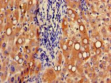 UGT1A9 Antibody - Immunohistochemistry of paraffin-embedded human liver tissue at dilution of 1:100