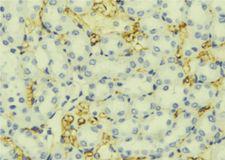 UGT1A9 Antibody - 1:100 staining mouse liver tissue by IHC-P. The sample was formaldehyde fixed and a heat mediated antigen retrieval step in citrate buffer was performed. The sample was then blocked and incubated with the antibody for 1.5 hours at 22°C. An HRP conjugated goat anti-rabbit antibody was used as the secondary.