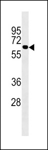 UGT2B10 Antibody - UGT2B10 Antibody western blot of 293 cell line lysates (35 ug/lane). The UGT2B10 antibody detected the UGT2B10 protein (arrow).