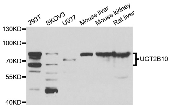 UGT2B10 Antibody - Western blot analysis of extracts of various cell lines.