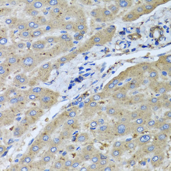 UGT2B10 Antibody - Immunohistochemistry of paraffin-embedded human liver injury tissue.