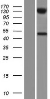 UGT2B10 Protein - Western validation with an anti-DDK antibody * L: Control HEK293 lysate R: Over-expression lysate