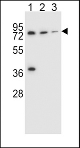 UGT2B15 Antibody - UGT2B15 Antibody western blot of NCI-H460(lane 1),HepG2(lane 2),ZR-75-1(lane 3) cell line lysates (35 ug/lane). The UGT2B15 antibody detected the UGT2B15 protein (arrow).