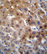 UGT2B15 Antibody - UGT2B15 Antibody immunohistochemistry of formalin-fixed and paraffin-embedded human liver tissue followed by peroxidase-conjugated secondary antibody and DAB staining.