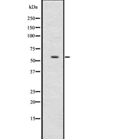 UGT2B17 Antibody - Western blot analysis of UGT2B using HepG2 whole lysates.