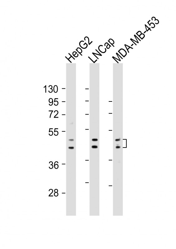 UGT2B4 Antibody - All lanes: Anti-UGT2B4 Antibody (Center) at 1:2000 dilution. Lane 1: HepG2 whole cell lysates. Lane 2: LNCap whole cell lysates. Lane 3: MDA-MB-453 whole cell lysates Lysates/proteins at 20 ug per lane. Secondary Goat Anti-Rabbit IgG, (H+L), Peroxidase conjugated at 1:10000 dilution. Predicted band size: 61 kDa. Blocking/Dilution buffer: 5% NFDM/TBST.