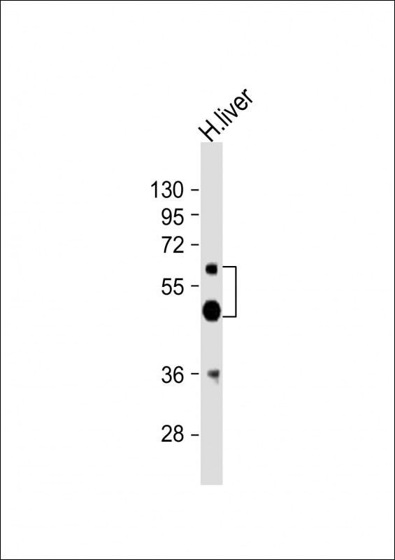 UGT2B4 Antibody - Anti-UGT2B4 Antibody (Center)at 1:2000 dilution + human liver lysates Lysates/proteins at 20 ug per lane. Secondary Goat Anti-Rabbit IgG, (H+L), Peroxidase conjugated at 1:10000 dilution. Predicted band size: 61 kDa. Blocking/Dilution buffer: 5% NFDM/TBST.
