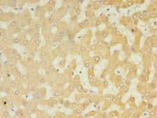 UGT2B4 Antibody - Immunohistochemistry of paraffin-embedded human liver tissue using antibody at 1:100 dilution.
