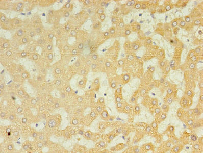 UGT2B4 Antibody - Immunohistochemistry of paraffin-embedded human liver tissue using UGT2B4 Antibody at dilution of 1:100