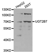 UGT2B7 Antibody - Western blot analysis of extracts of various cell lines, using UGT2B7 antibody at 1:1000 dilution. The secondary antibody used was an HRP Goat Anti-Rabbit IgG (H+L) at 1:10000 dilution. Lysates were loaded 25ug per lane and 3% nonfat dry milk in TBST was used for blocking.
