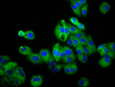 UGT2B7 Antibody - Immunofluorescence staining of HepG2 cells diluted at 1:100, counter-stained with DAPI. The cells were fixed in 4% formaldehyde, permeabilized using 0.2% Triton X-100 and blocked in 10% normal Goat Serum. The cells were then incubated with the antibody overnight at 4°C.The Secondary antibody was Alexa Fluor 488-congugated AffiniPure Goat Anti-Rabbit IgG (H+L).