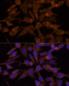 UGT2B7 Antibody - Immunofluorescence analysis of HeLa cells using UGT2B7 Polyclonal Antibody at dilution of 1:100 (40x lens).Blue: DAPI for nuclear staining.