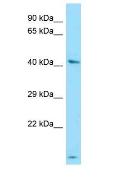 UGT3A1 Antibody - UGT3A1 antibody Western Blot of HepG2. Antibody dilution: 1 ug/ml.  This image was taken for the unconjugated form of this product. Other forms have not been tested.