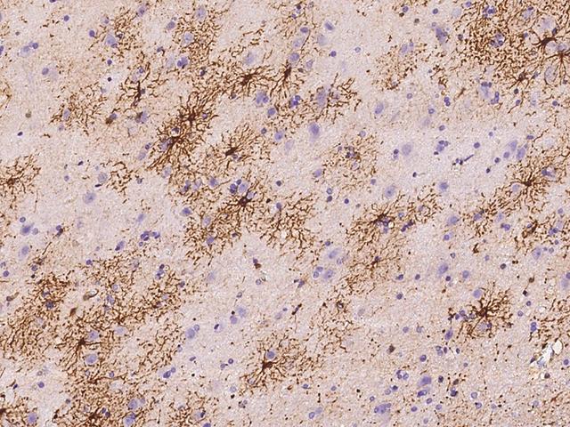 UGT3A1 Antibody - Immunochemical staining of human Ugt3a1 in human brain with rabbit polyclonal antibody at 1:100 dilution, formalin-fixed paraffin embedded sections.