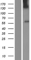 UGT3A1 Protein - Western validation with an anti-DDK antibody * L: Control HEK293 lysate R: Over-expression lysate