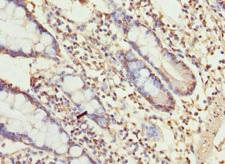 UGT3A2 Antibody - Immunohistochemistry of paraffin-embedded human small intestine tissue at dilution 1:100