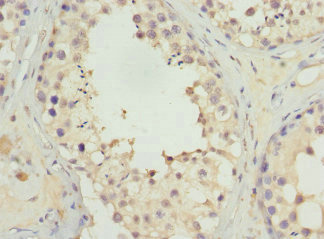 UGT3A2 Antibody - Immunohistochemistry of paraffin-embedded human testis tissue at dilution 1:100