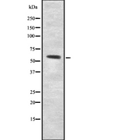 UGT8 Antibody - Western blot analysis UGT8 using MCF-7 whole cells lysates