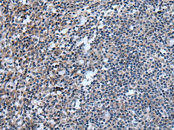 UGT8 Antibody - Immunohistochemistry of paraffin-embedded Human tonsil tissue  using UGT8 Polyclonal Antibody at dilution of 1:55(×200)