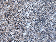 UGT8 Antibody - Immunohistochemistry of paraffin-embedded Human tonsil tissue  using UGT8 Polyclonal Antibody at dilution of 1:55(×200)