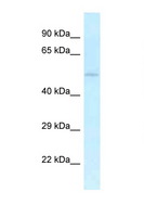 UHMK1 / KIS Antibody - UHMK1 / KIST antibody Western blot of Mouse Heart lysate. Antibody concentration 1 ug/ml.  This image was taken for the unconjugated form of this product. Other forms have not been tested.