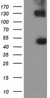 UHMK1 / KIS Antibody - HEK293T cells were transfected with the pCMV6-ENTRY control (Left lane) or pCMV6-ENTRY UHMK1 (Right lane) cDNA for 48 hrs and lysed. Equivalent amounts of cell lysates (5 ug per lane) were separated by SDS-PAGE and immunoblotted with anti-UHMK1.