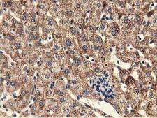 UHMK1 / KIS Antibody - Immunohistochemical staining of paraffin-embedded Human liver tissue using anti-UHMK1 mouse monoclonal antibody.