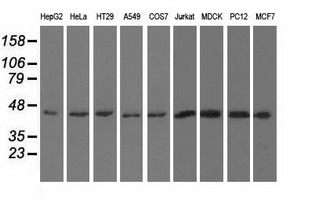 UHMK1 / KIS Antibody - Western blot of extracts (35 ug) from 9 different cell lines by using anti-UHMK1 monoclonal antibody.