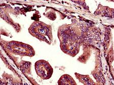 UHMK1 / KIS Antibody - Immunohistochemistry image of paraffin-embedded human prostate tissue at a dilution of 1:100