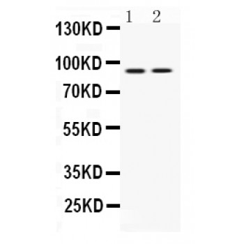 UHRF1 Antibody - Western blot analysis of UHRF1 expression in MCF-7 whole cell lysates (lane 1) and U2OS whole cell lysates (lane 2). UHRF1 at 90 kD was detected using rabbit anti- UHRF1 Antigen Affinity purified polyclonal antibody at 0.5 ug/mL. The blot was developed using chemiluminescence (ECL) method.