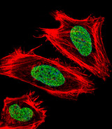 UHRF1 Antibody - Fluorescent confocal image of HeLa cell stained with UHRF1 Antibody. HeLa cells were fixed with 4% PFA (20 min), permeabilized with Triton X-100 (0.1%, 10 min), then incubated with UHRF1 primary antibody (1:25, 1 h at 37°C). For secondary antibody, Alexa Fluor 488 conjugated donkey anti-rabbit antibody (green) was used (1:400, 50 min at 37°C). Cytoplasmic actin was counterstained with Alexa Fluor 555 (red) conjugated Phalloidin (7units/ml, 1 h at 37°C). Nuclei were counterstained with DAPI (blue) (10 ug/ml, 10 min). UHRF1 immunoreactivity is localized to Nucleus significantly.