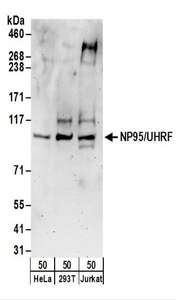 UHRF1 Antibody - Detection of Human NP95/UHRF by Western Blot. Samples: Whole cell lysate (50 ug) from HeLa, 293T, and Jurkat cells. Antibodies: Affinity purified rabbit anti-NP95/UHRF antibody used for WB at 0.04 ug/ml. Detection: Chemiluminescence with an exposure time of 3 minutes.