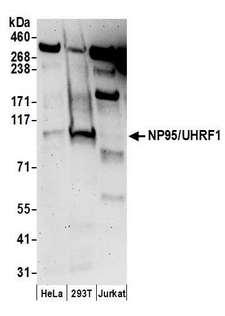 UHRF1 Antibody - Detection of human NP95/UHRF1 by western blot. Samples: Whole cell lysate (50 µg) from HeLa, HEK293T, and Jurkat cells prepared using NETN lysis buffer. Antibodies: Affinity purified rabbit anti-NP95/UHRF1 antibody used for WB at 0.1 µg/ml. Detection: Chemiluminescence with an exposure time of 3 minutes.