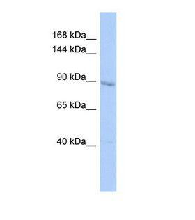 UHRF1 Antibody - Western blot of Human HepG2. UHRF1 antibody dilution 1.0 ug/ml.  This image was taken for the unconjugated form of this product. Other forms have not been tested.