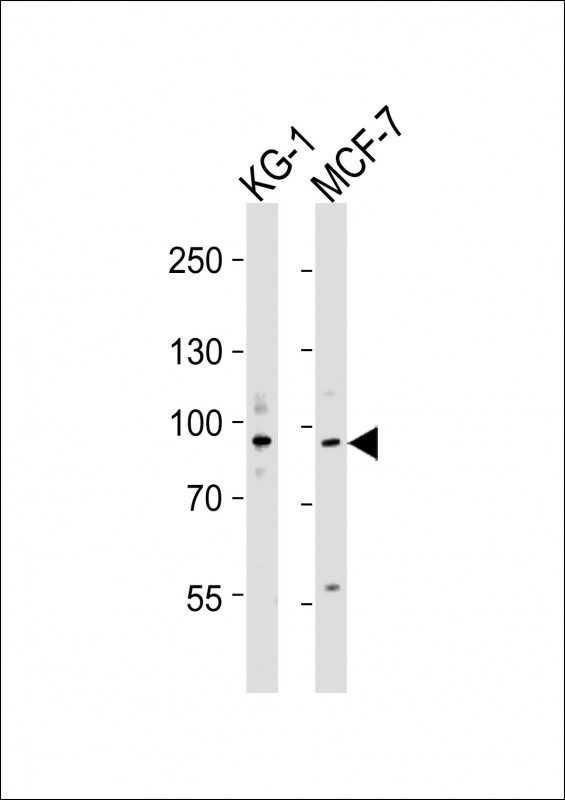 UHRF1 Antibody - All lanes : Anti-UHRF1 Antibody at 1:4000 dilution Lane 1: KG-1 whole cell lysates Lane 2: MCF-7 whole cell lysates Lysates/proteins at 20 ug per lane. Secondary Goat Anti-Rabbit IgG, (H+L), Peroxidase conjugated at 1/10000 dilution Predicted band size : 90 kDa Blocking/Dilution buffer: 5% NFDM/TBST.